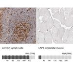 LAP3 Antibody