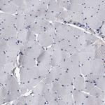 EFCAB7 Antibody in Immunohistochemistry (IHC)