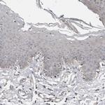 CHML Antibody in Immunohistochemistry (Paraffin) (IHC (P))