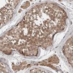 CHML Antibody in Immunohistochemistry (Paraffin) (IHC (P))