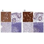 SNAP91 Antibody in Immunohistochemistry (IHC)