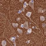 SNAP91 Antibody in Immunohistochemistry (IHC)