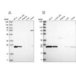 PSMB1 Antibody in Western Blot (WB)