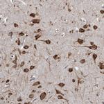 CCDC47 Antibody in Immunohistochemistry (Paraffin) (IHC (P))