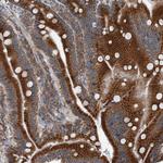 CCDC47 Antibody in Immunohistochemistry (Paraffin) (IHC (P))