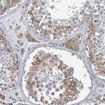 CCDC47 Antibody in Immunohistochemistry (Paraffin) (IHC (P))