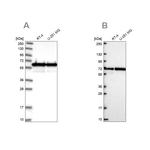 CCDC47 Antibody in Western Blot (WB)