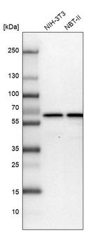 CCDC47 Antibody in Western Blot (WB)