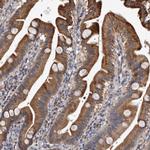 RCL Antibody in Immunohistochemistry (IHC)