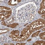 RCL Antibody in Immunohistochemistry (IHC)