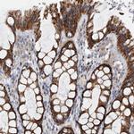 PDSS2 Antibody in Immunohistochemistry (IHC)