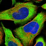 PDSS2 Antibody in Immunocytochemistry (ICC/IF)