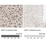 MAP7 Antibody in Immunohistochemistry (IHC)