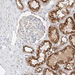 MAP7 Antibody in Immunohistochemistry (IHC)