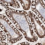 MAP7 Antibody in Immunohistochemistry (IHC)