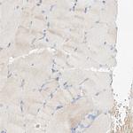 MAP7 Antibody in Immunohistochemistry (IHC)