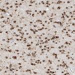 MAP7 Antibody in Immunohistochemistry (IHC)