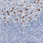 MAP7 Antibody in Immunohistochemistry (IHC)