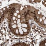 RAD23B Antibody in Immunohistochemistry (IHC)