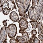 RAD23B Antibody in Immunohistochemistry (IHC)