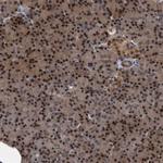 RAD23B Antibody in Immunohistochemistry (IHC)