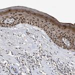 RAD23B Antibody in Immunohistochemistry (IHC)