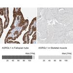 ALP Antibody in Immunohistochemistry (IHC)