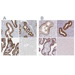 ALP Antibody in Immunohistochemistry (IHC)