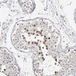 ALP Antibody in Immunohistochemistry (IHC)