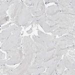 ALP Antibody in Immunohistochemistry (IHC)