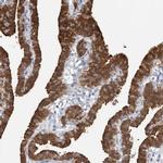 ALP Antibody in Immunohistochemistry (IHC)