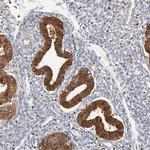 ALP Antibody in Immunohistochemistry (IHC)