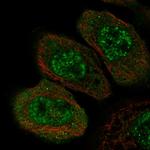 ZNF543 Antibody in Immunocytochemistry (ICC/IF)