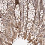 ZNF543 Antibody in Immunohistochemistry (Paraffin) (IHC (P))