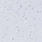 LALBA Antibody in Immunohistochemistry (Paraffin) (IHC (P))