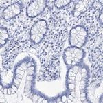 LALBA Antibody in Immunohistochemistry (Paraffin) (IHC (P))