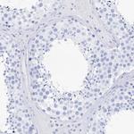 LALBA Antibody in Immunohistochemistry (Paraffin) (IHC (P))