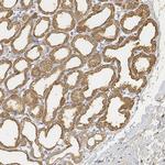 LALBA Antibody in Immunohistochemistry (IHC)