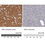 Tenascin R Antibody in Immunohistochemistry (IHC)