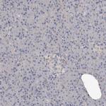 Tenascin R Antibody in Immunohistochemistry (IHC)