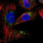 SLC25A20 Antibody in Immunocytochemistry (ICC/IF)