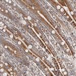 SLC25A20 Antibody in Immunohistochemistry (Paraffin) (IHC (P))