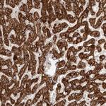 SLC25A20 Antibody in Immunohistochemistry (Paraffin) (IHC (P))