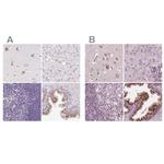 KIAA1324 Antibody in Immunohistochemistry (IHC)