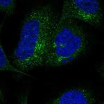 SLC26A11 Antibody in Immunocytochemistry (ICC/IF)