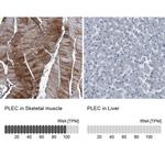 Plectin Antibody