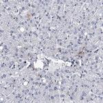 FTSJD2 Antibody in Immunohistochemistry (Paraffin) (IHC (P))