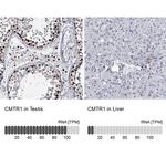 FTSJD2 Antibody in Immunohistochemistry (IHC)