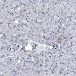 FTSJD2 Antibody in Immunohistochemistry (IHC)