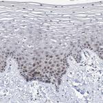 NUFIP1 Antibody in Immunohistochemistry (IHC)